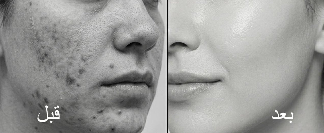 بشرتك تستحق الأفضل — وهذا ليس خطأك - Safe Sun - Korean Skincare, Cosmetics & SPF Protection